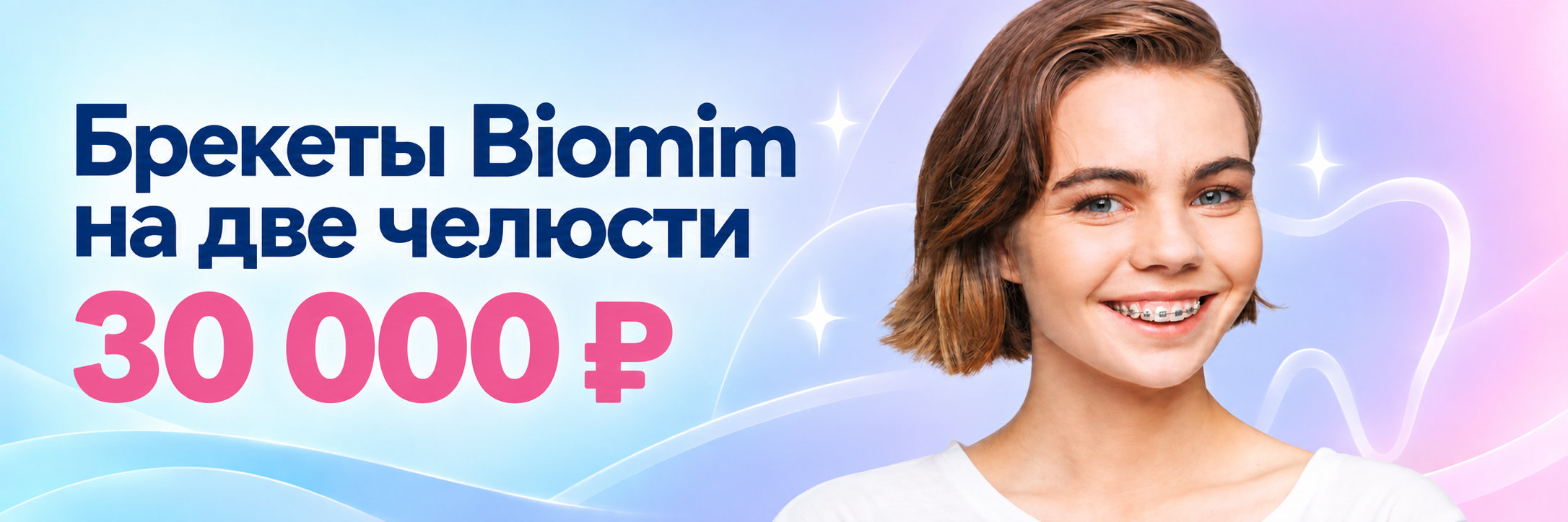Брекеты Biomim на 2 челюсти