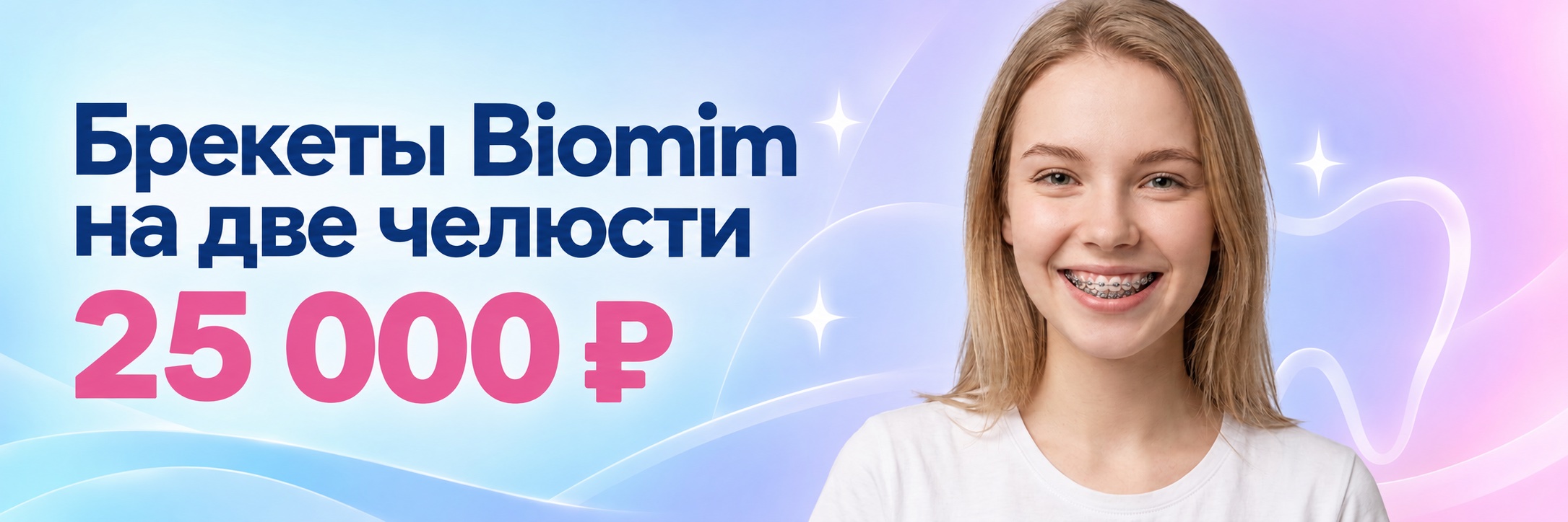 Брекеты Biomim на 2 челюсти